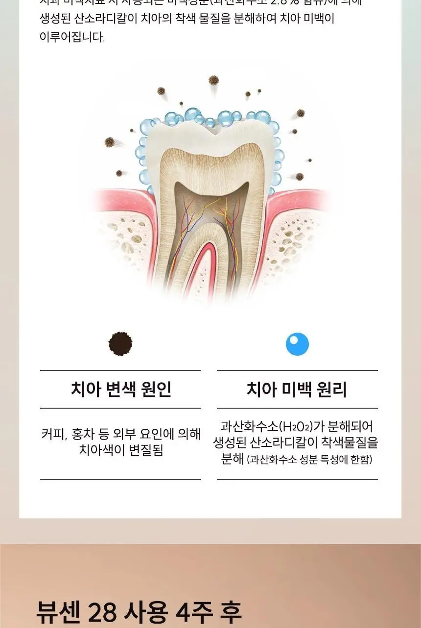 [집중 미백케어] 뷰센28 치아미백제 플로랄민트향 80g 상세페이지 13